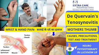 De Quervain's Tenosynovitis in Hindi | अंगूठे में दर्द का ईलाज | Mothers Thumb | Gamers Thumb