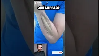 ¿Qué rayos le pasó en el brazo???