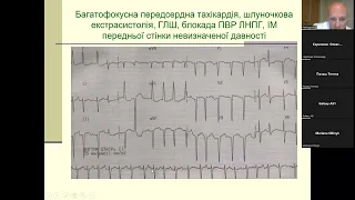 Суправентрикулярні тахікардії (частина 2)