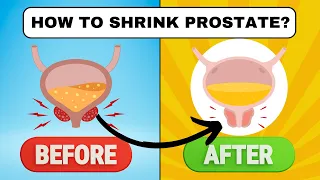 How to Shrink Prostate? Top 6 Vitamins to Prevent Prostate Enlargement!