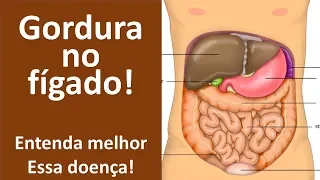 Gordura no fígado! Entenda melhor essa doença! | Dr. Marco Menelau