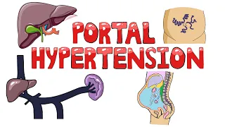 Portal Hypertension - Causes of Portal Hypertension (Pre/Intra/Post Hepatic) | Symptoms & Diagnosis