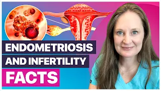 5 Ways Endometriosis Impacts Fertility: What You Need to Know Now