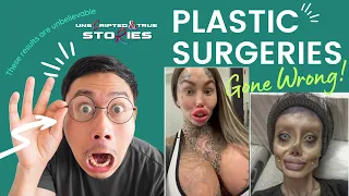 5 Terrifying Celebrity Plastic Surgery Disasters | Biggest & Epic Plastic Surgery Fail