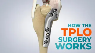 CCL Tears and How a TPLO Surgery Works