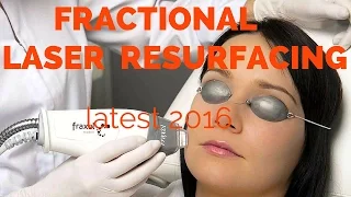 Fractional laser resurfacing- dermatologist review