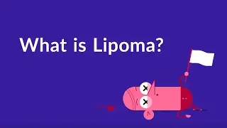 What is Lipoma? (Fat Lump Under Skin)