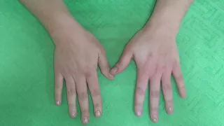 Самомассаж кистей рук