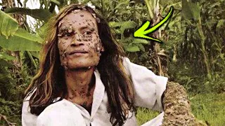 10 Unusual People Who Suffer Very Rare Conditions