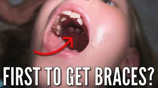 Finally, Someone is Getting Braces...and Separators, and an Expander! | Who Is the Lucky One??