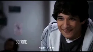 Scott McCall (Before,After)