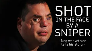 "A sniper's bullet tore my face apart." Iraq war hero tells his incredible story.