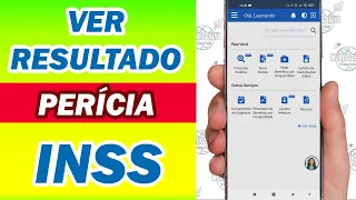 Como Ver o Resultado da Pericia do INSS | Tire suas Dúvidas!