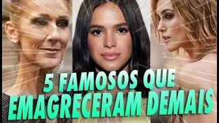 FAMOSOS QUE EMAGRECERAM DEMAIS