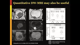 ISMRM MR Academy - Bladder CA Staging