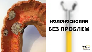 Как делать колоноскопию. Многопрофильная клиника "Скандинавия​".How to perform colonoscopy procedure