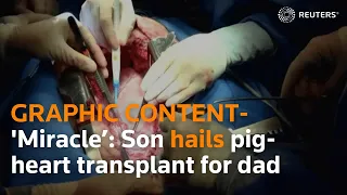 GRAPHIC CONTENT - 'Miracle’: Son hails pig-heart transplant for dad