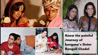 Do You Know The Whole Acid Attack Story of kangana Ranaut's Sister Rangoli Chandel