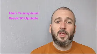 FUE Hair Transplant Recovery - Week 10