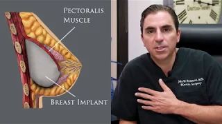 Breast Implants and Breast Augmentation - Clinique Dallas Plastic Surgery