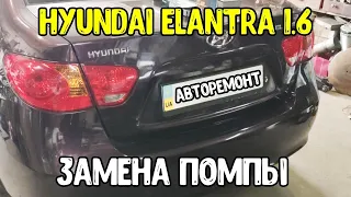 Hyundai Elantra 1.6 замена помпы