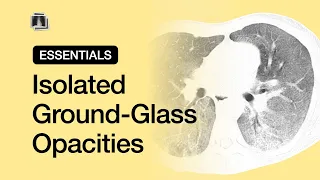 Isolated Ground-Glass Opacities | Chest Radiology Essentials