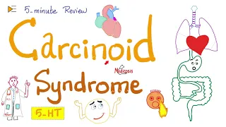 Carcinoid Syndrome | Serotonin-Secreting Tumors | 5-Minute Review 🖐