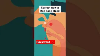 Nosebleeds: Lean forward vs Lean Backwards?