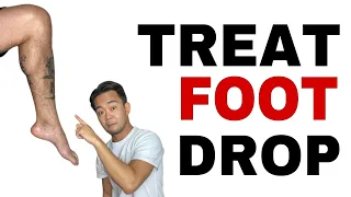 How to Treat Drop Foot | Foot Drop