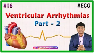 16. Ventricular Arrhythmias (Part 2) - ECG assessment and ECG interpretation made easy