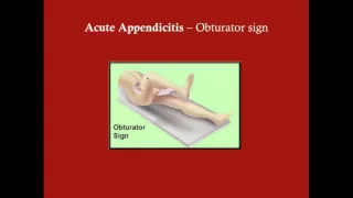 Acute Appendicitis - CRASH! Medical Review Series