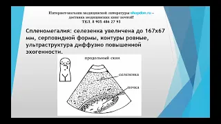 Спленомегалия.  УЗИ селезенки. Бесплатный медицинский журнал "МедДон".