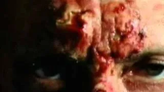 Secrets Of The Dead - The Syphillis Enigma 1of 4