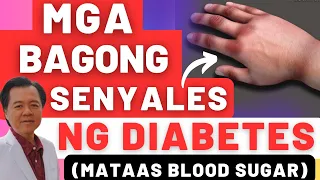 Mga Bagong Senyales ng Diabetes (Mataas Blood Sugar) - By Doc Willie Ong