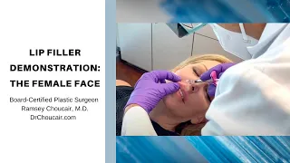 Lip Filler Demonstration | Ramsey Choucair, M.D. | Dallas, Texas | Ph: 214-398-9797