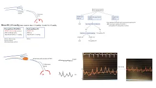 Pulmonary hypertension hemodynamics: misunderstood concepts, tips and tricks- Elias Hanna, Univ Iowa