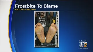 Antonio Brown Comes Home With Frostbit Feet