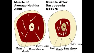 Thought Experiment on Sarcopenia / would once a month training make a difference?