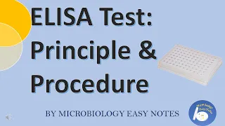 ELISA: Principle & Procedure