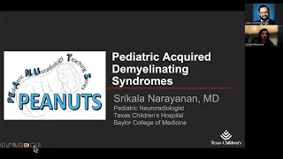 Pediatric acquired demyelinating syndromes -- Dr. Srikala Narayanan -- 3.14.2024