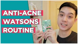 My Drugstore ANTI-ACNE Routine (Watsons) | Jan Angelo
