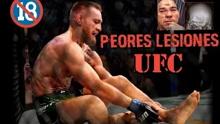 LAS PEORES LESIONES  EN LA HISTORIA DE UFC - MMA