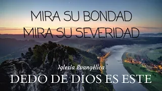 "Mira su bondad   Mira su severidad" (Romanos 11:22)