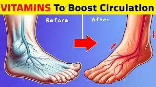 Top 7 Vitamins To Boost Legs and Foot Circulation Instantly!