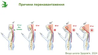 Як мати здоровий хребет та кістки. Алгоритм дій. Остеохондроз, грижі, протрузії.