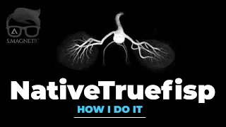 NativeTruefisp – “HOW I DO IT”