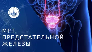 ♂ Когда показано проведение МРТ предстательной железы? МРТ предстательной железы. МНОЦ МГУ. 18+