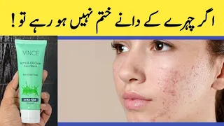 Acne face wash ||Vince face Wash for Acne||Sulphate free face wash