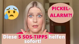 PICKEL IM SOMMER: Mit diesen 5 TIPPS bleiben sie weg | Anti-Akne | Anti-Pickel-Routine