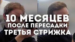 ВЛОГ 11 - 10 Месяцев с пересадки волос, Стрижка, Работа, Усталость